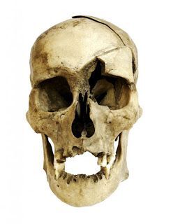 Restos con heridas de arma blanca, los acarreaderos.