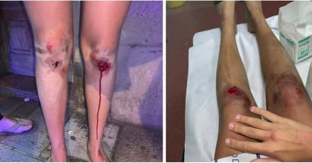 accidentada