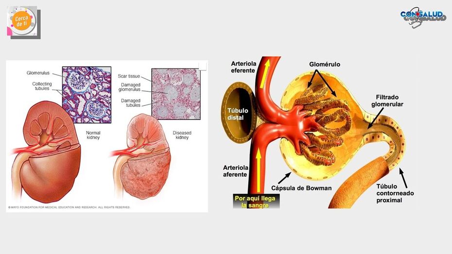 diagramaimagenesrenales
