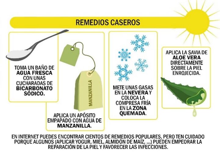 quemaduras05