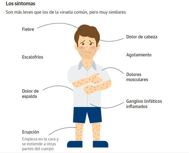 viruela04